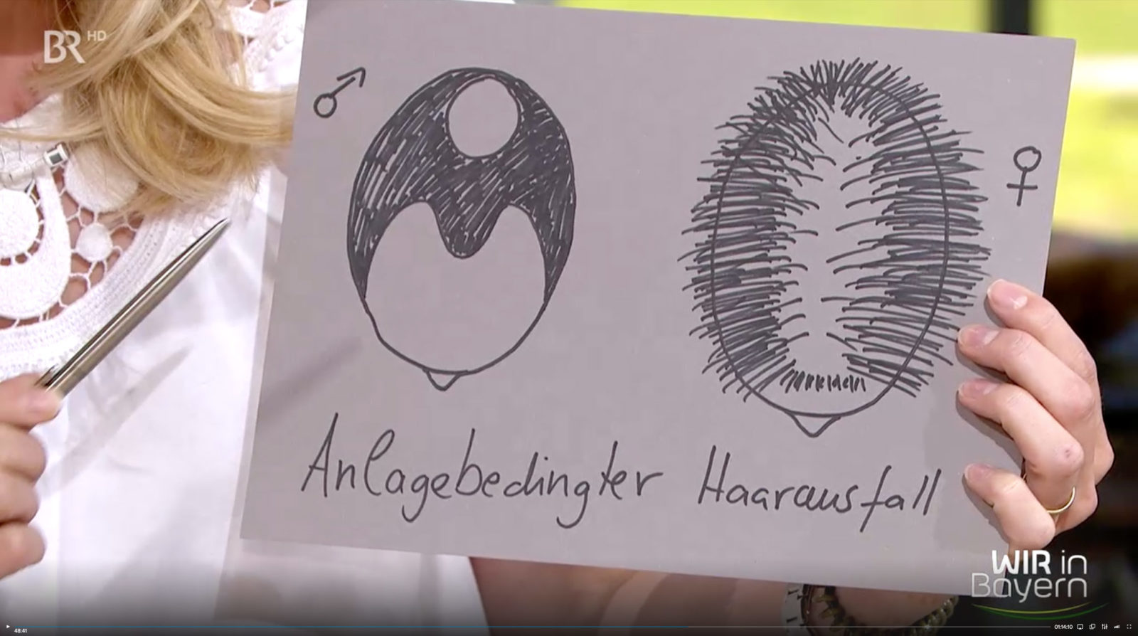Dr. med. Monique Stengel, BR, Wir in Bayern, 17.06.19 Thema Haarausfall