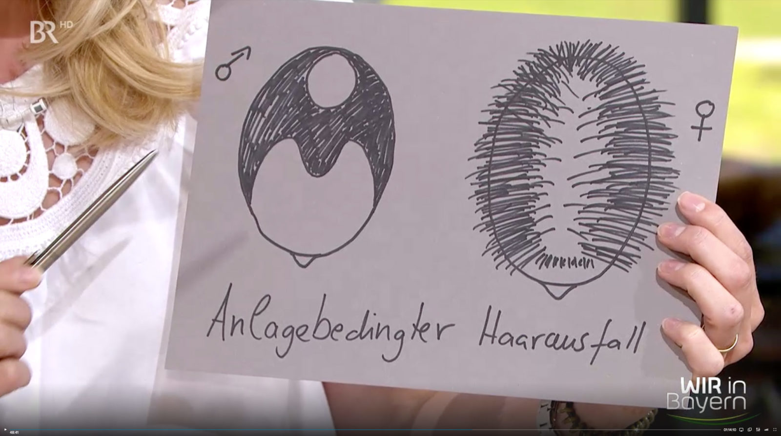 Dr. med. Monique Stengel, BR, Wir in Bayern, 17.06.19 Thema Haarausfall Dr. med. Monique Stengel, BR, Wir in Bayern, 17.06.19 Thema Haarausfall