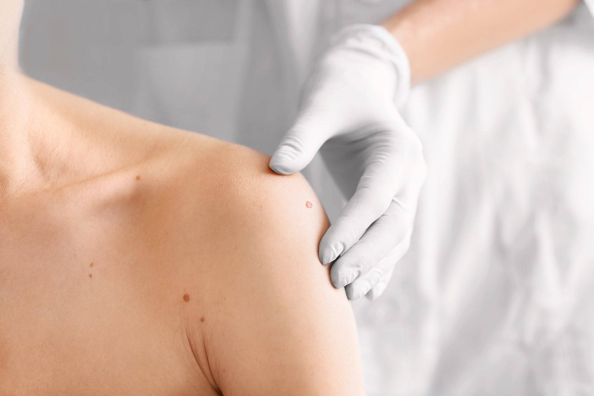 MKC-Chirurgie bei Hauttumoren – mikrographisch kontrollierte Entfernung mit maximalem Gewebeerhalt