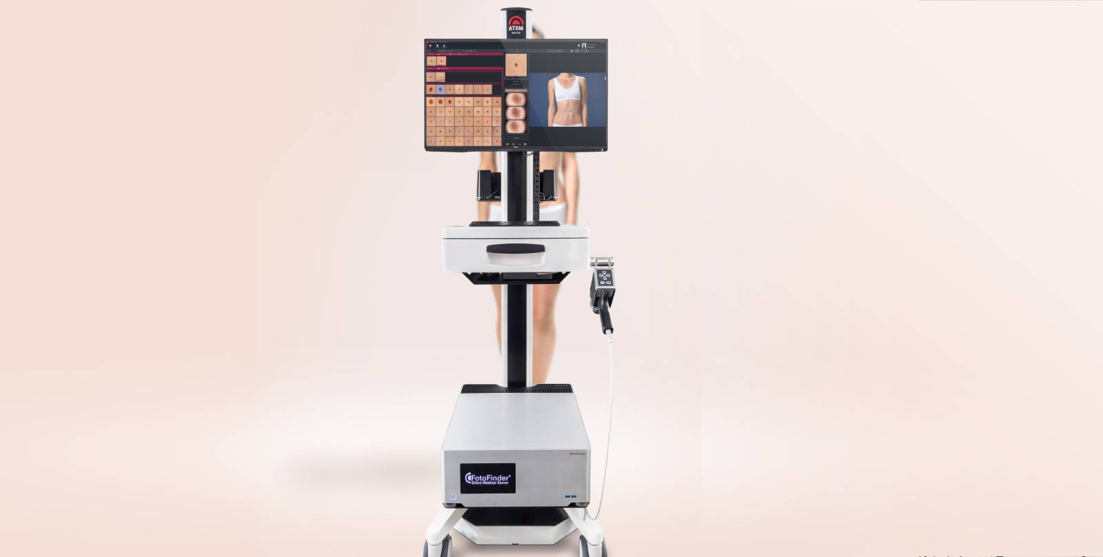 TotalBodyMapping Automatisiertes Total Body Mapping (ATBM®) Gerät in der Dermatologie am Starnberger See zur digitalen Hautkrebsvorsorge und Verlaufskontrolle von Muttermalen